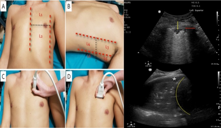 Fig. 2